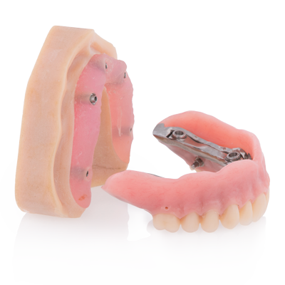 SERVICE_Implants